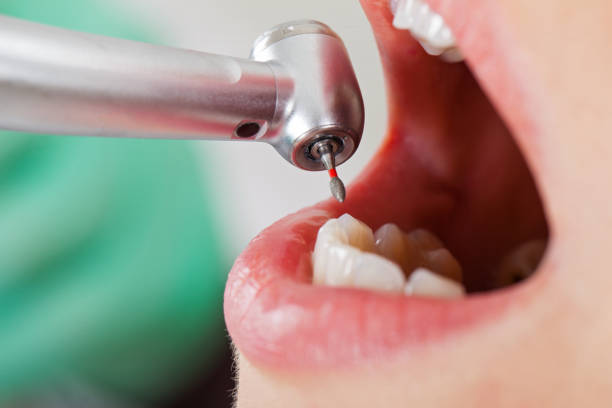 Best Knocked-Out Tooth Emergency  in Gillette, WY